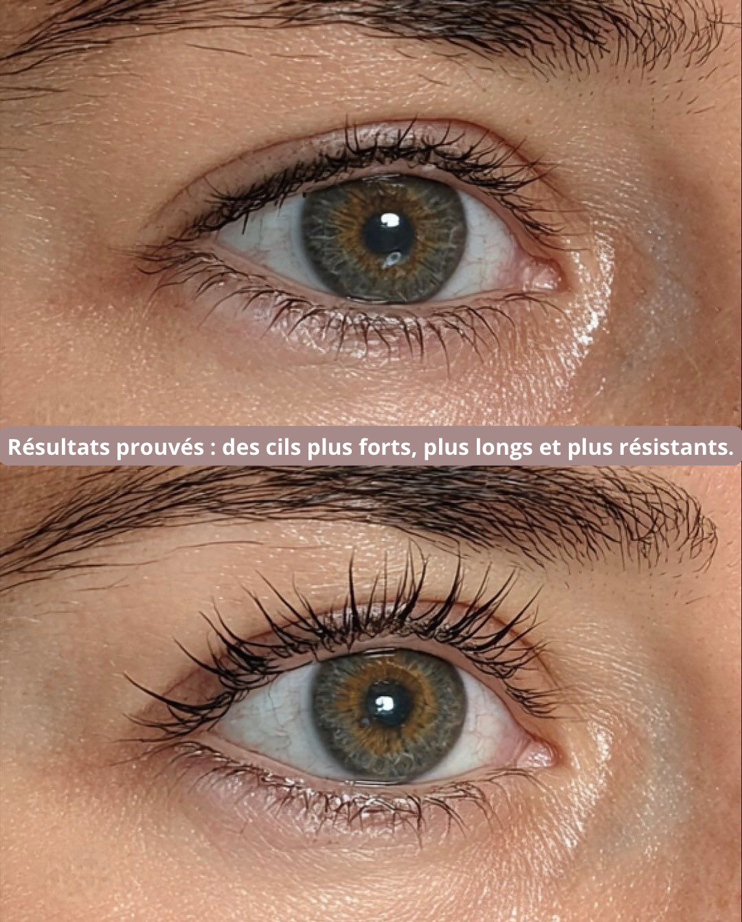 REMEDY LASH